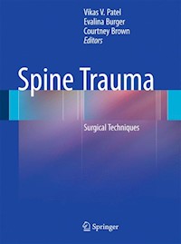 Spine Trauma -  - E-Book