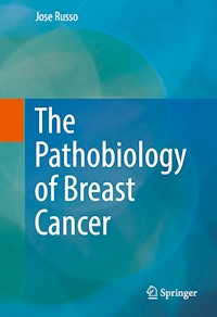 The Pathobiology of Breast Cancer - Jose Russo - E-Book