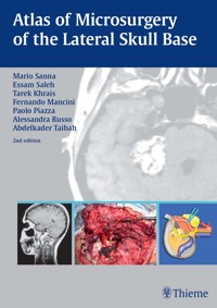 Atlas of Microsurgery of the Lateral Skull Base - Mario Sanna - E-Book