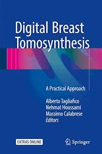 Digital Breast Tomosynthesis -  - E-Book