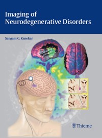 Imaging of Neurodegenerative Disorders -  - E-Book