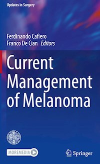 Current Management of Melanoma -  - E-Book