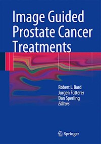 Image Guided Prostate Cancer Treatments -  - E-Book