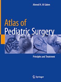 Atlas of Pediatric Surgery - Ahmed H. Al-Salem - E-Book