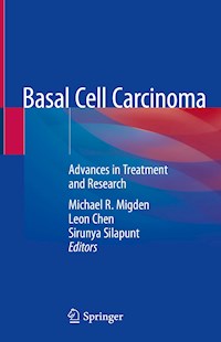 Basal Cell Carcinoma -  - E-Book