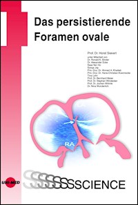 Das persistierende Foramen ovale - Horst Sievert - E-Book