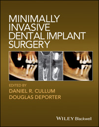 Minimally Invasive Dental Implant Surgery - Daniel R. Cullum - E-Book