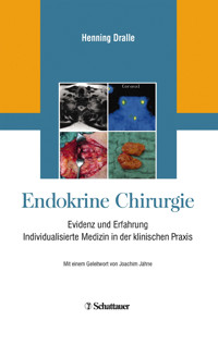Endokrine Chirurgie -  - E-Book
