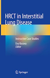 HRCT in Interstitial Lung Disease -  - E-Book