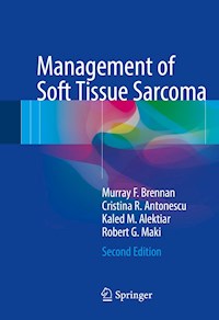 Management of Soft Tissue Sarcoma - Murray F. Brennan - E-Book