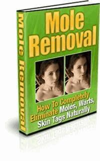 Mole Removal - Ouvrage Collectif - E-Book