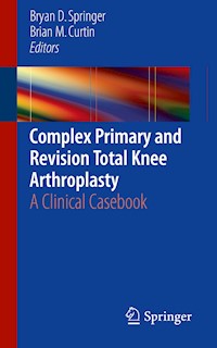 Complex Primary and Revision Total Knee Arthroplasty - - E-Book
