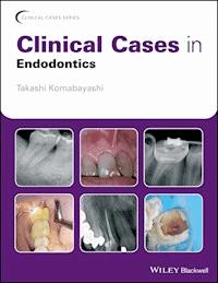 Clinical Cases in Endodontics - Takashi Komabayashi - E-Book