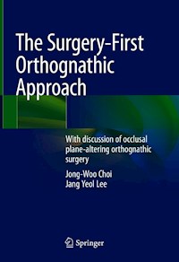 The Surgery-First Orthognathic Approach - Jong-Woo Choi - E-Book
