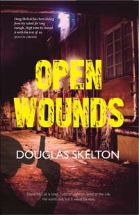 Open Wounds - Douglas Skelton - E-Book