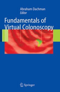 Fundamentals of Virtual Colonoscopy -  - E-Book
