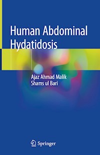 Human Abdominal Hydatidosis - Ajaz Ahmad Malik - E-Book