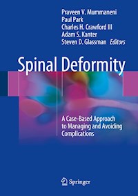 Spinal Deformity -  - E-Book