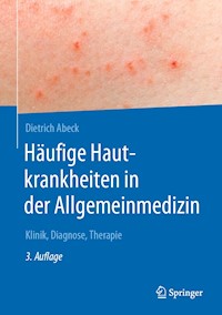 Häufige Hautkrankheiten in der Allgemeinmedizin - Dietrich Abeck - E-Book
