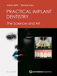 Practical Implant Dentistry - Ashok Sethi - E-Book