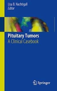 Pituitary Tumors -  - E-Book