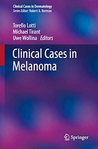 Clinical Cases in Melanoma - - E-Book