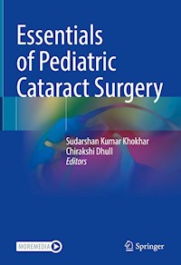 Essentials of Pediatric Cataract Surgery -  - E-Book