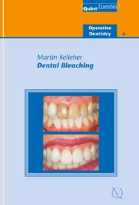 Dental Bleaching - Martin Kelleher - E-Book