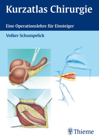 Kurzatlas Chirurgie - Volker Schumpelick - E-Book