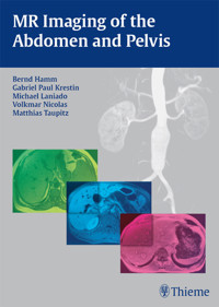 MR Imaging of the Abdomen and Pelvis - Bernd Hamm - E-Book