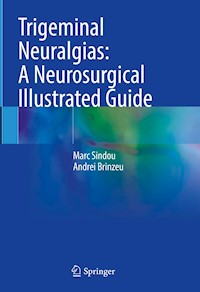 Trigeminal Neuralgias: A Neurosurgical Illustrated Guide - Marc Sindou - E-Book