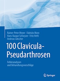 100 Clavicula-Pseudarthrosen - Rainer-Peter Meyer - E-Book
