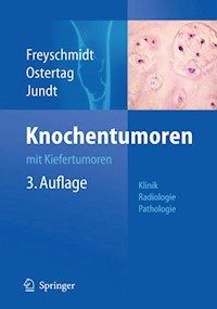 Knochentumoren mit Kiefertumoren - Jürgen Freyschmidt - E-Book