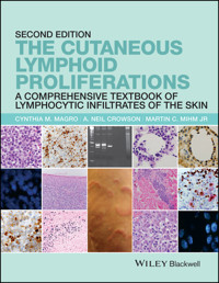 The Cutaneous Lymphoid Proliferations - Cynthia M. Magro - E-Book