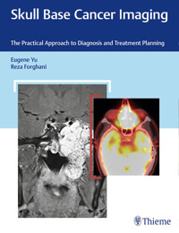 Skull Base Cancer Imaging - Eugene Yu - E-Book