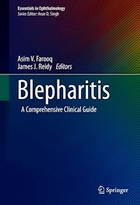 Blepharitis -  - E-Book