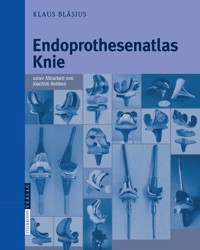 Endoprothesenatlas Knie - Klaus Bläsius - E-Book