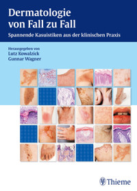 Dermatologie von Fall zu Fall -  - E-Book