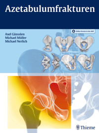 Azetabulumfrakturen -  - E-Book