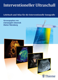 Interventioneller Ultraschall -  - E-Book