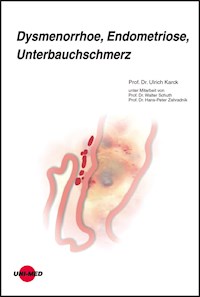 Dysmenorrhoe, Endometriose, Unterbauchschmerz - Ulrich Karck - E-Book