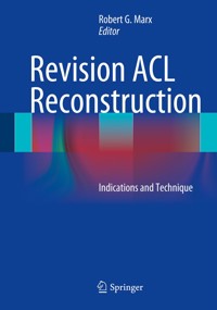 Revision ACL Reconstruction -  - E-Book