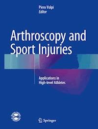Arthroscopy and Sport Injuries -  - E-Book