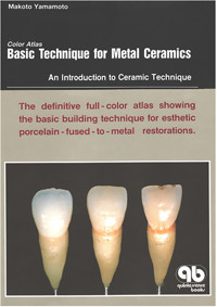 Color Atlas Basic Technique for Metal Ceramics - Makoto Yamamoto - E-Book