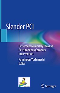 Slender PCI -  - E-Book