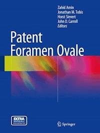 Patent Foramen Ovale -  - E-Book