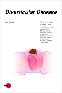 Diverticular Disease - Wolfgang Kruis - E-Book