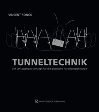Tunneltechnik - Vincent Ronco - E-Book