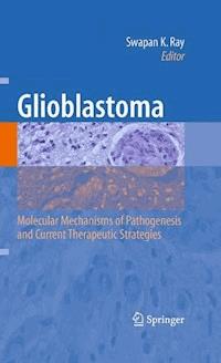Glioblastoma: - - E-Book
