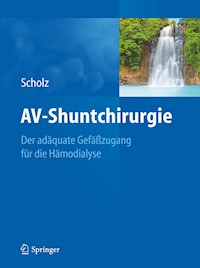 AV-Shuntchirurgie - Hans Scholz - E-Book